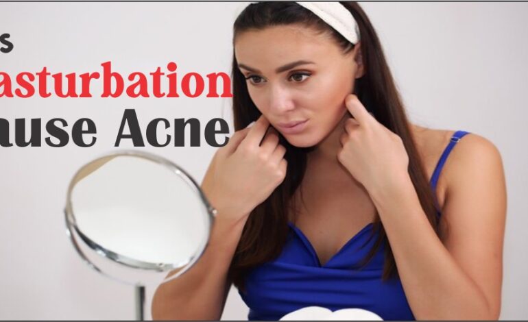  Does Masturbation Cause Acne? Separating Fact from Fiction
